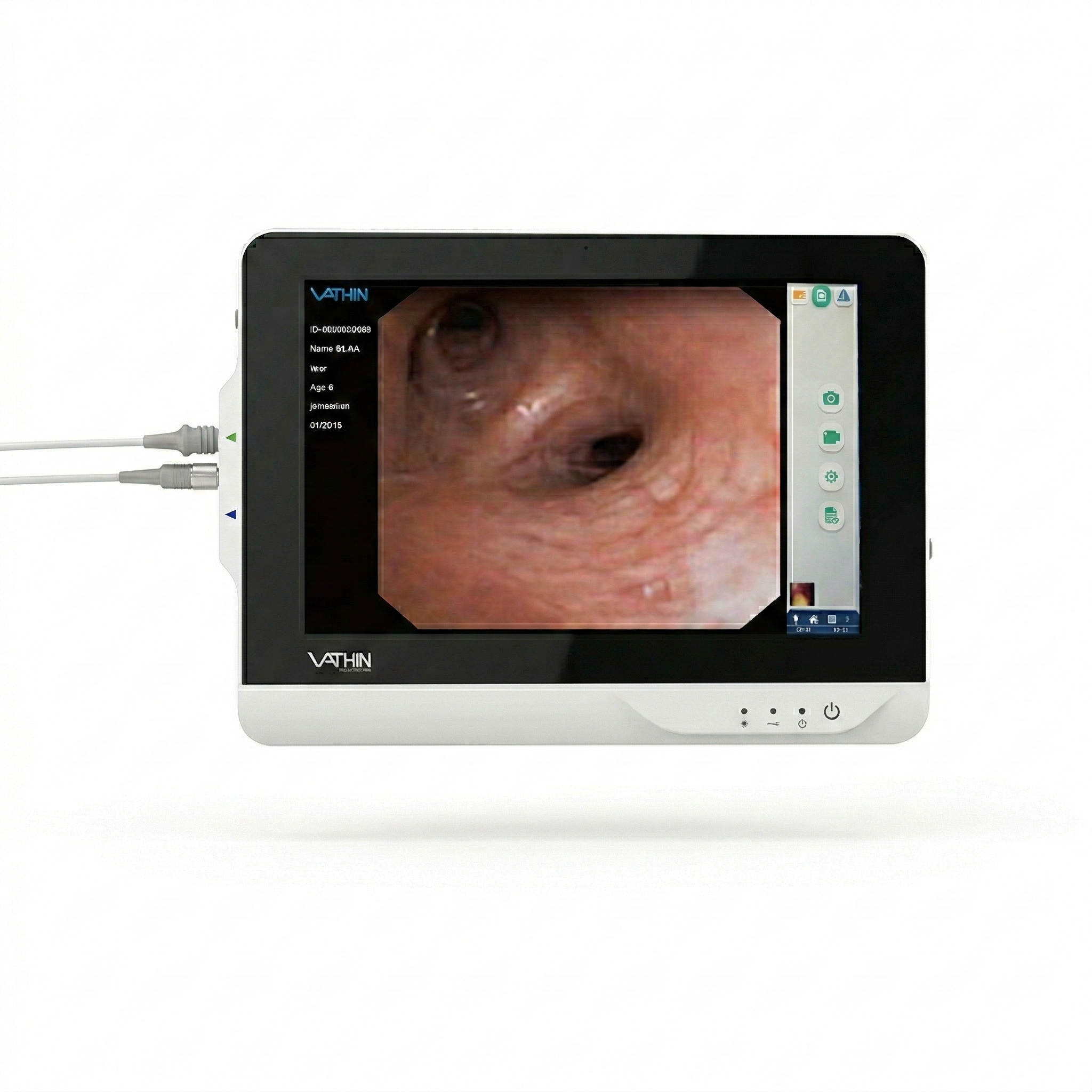 Monitor portátil para endoscópio flexível DVM-A1